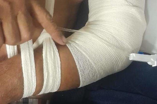 WATCH | ‘This is really bad’: Robbery, shootings leave Bloemfontein community fearful