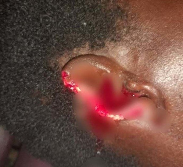 Man ‘chews’ off wife's ear in scuffle at Dambai
