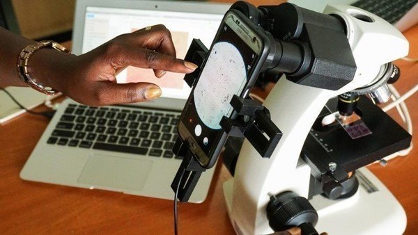 Uganda's first Artificial Intelligence (AI) lab has launched a malaria detecting smartphone app