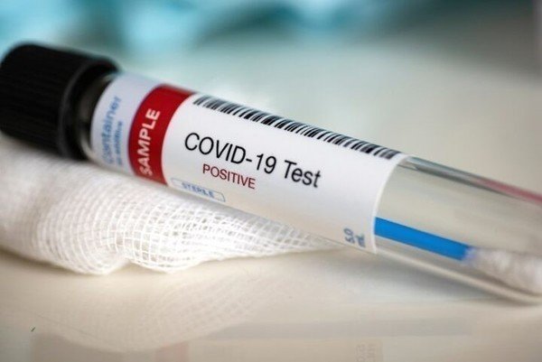 Two cases of Omicron COVID variant detected in Nigeria