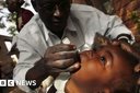 Malawi finds Africa’s first wild polio case in five years