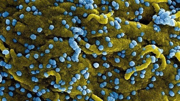 Marburg Virus Outbreak in Rwanda: Should We Be Alarmed?