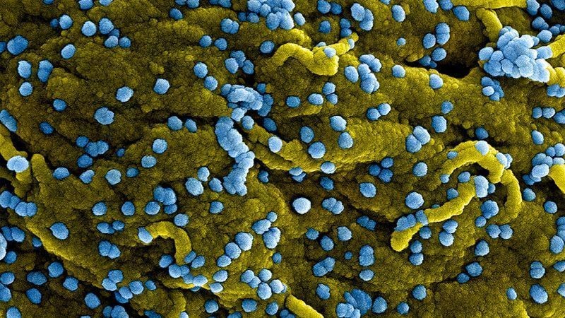 Marburg Virus Outbreak in Rwanda: Should We Be Alarmed?