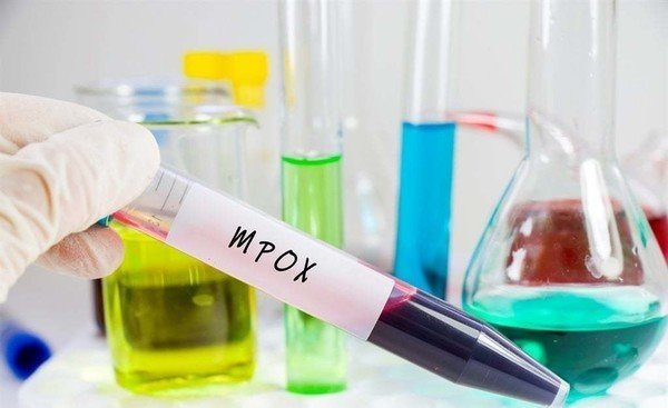 Mpox outbreak: New variant, local transmission sparks concern among Gauteng health officials