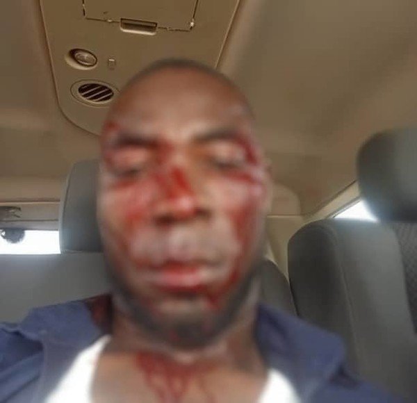 Tensions flare in Binduri as newly elected PM beaten after D...